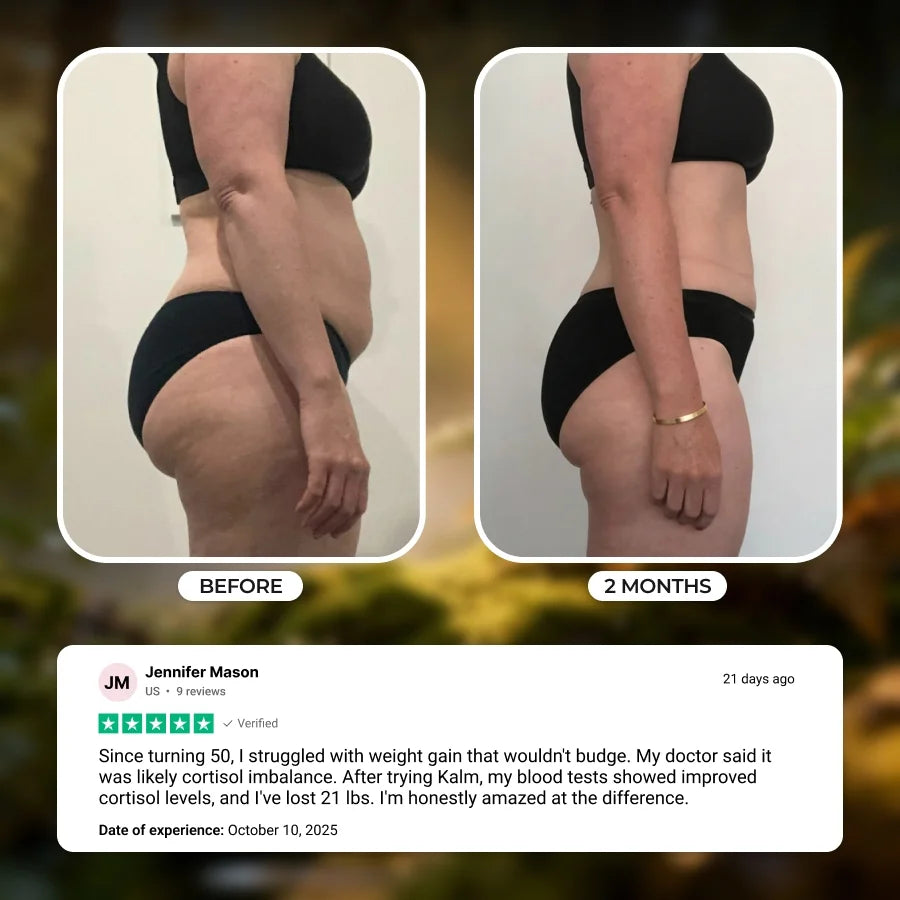 Kalm Bracelet - Your Weight Loss Solution